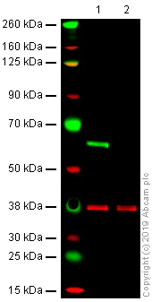 Western blot - Anti-Lamin B Receptor/LBR antibody [BBmLBR 12.F8] - BSA and Azide free (AB269576)