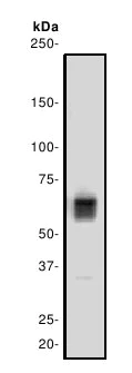 Western blot - Anti-Lamin B Receptor/LBR antibody [E398L] (AB32535)
