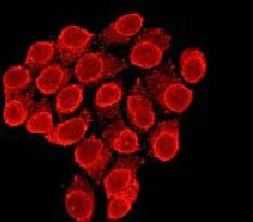 Immunocytochemistry/ Immunofluorescence - Anti-Lamin B Receptor/LBR antibody [E398L] - BSA and Azide free (AB222391)