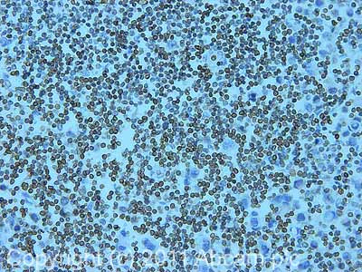 Immunohistochemistry (Formalin/PFA-fixed paraffin-embedded sections) - Anti-Lamin B Receptor/LBR antibody [E398L] - BSA and Azide free (AB222391)