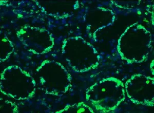 Anti-Lamin B1 antibody [119D5-F1] - Nuclear Envelope Marker