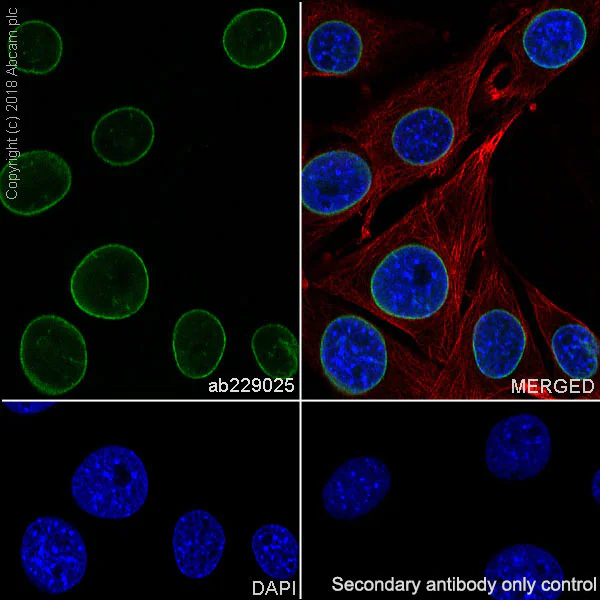 Immunocytochemistry/ Immunofluorescence - Anti-Lamin B1 antibody [EPR22165-121] - Nuclear Envelope Marker (AB229025)