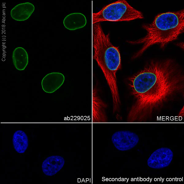 Immunocytochemistry/ Immunofluorescence - Anti-Lamin B1 antibody [EPR22165-121] - Nuclear Envelope Marker (AB229025)