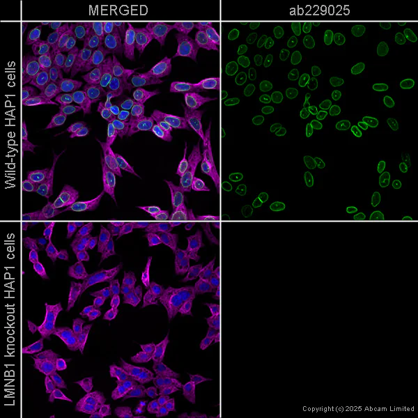 Immunocytochemistry/ Immunofluorescence - Anti-Lamin B1 antibody [EPR22165-121] - Nuclear Envelope Marker (AB229025)