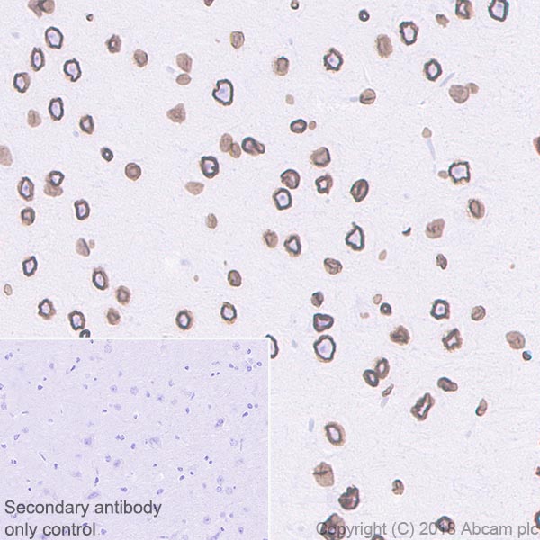 Immunohistochemistry (Formalin/PFA-fixed paraffin-embedded sections) - Anti-Lamin B1 antibody [EPR22165-121] - Nuclear Envelope Marker (ab229025), expandable thumbnail