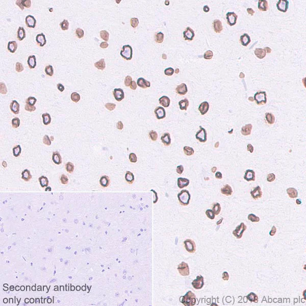 Immunohistochemistry (Formalin/PFA-fixed paraffin-embedded sections) - Anti-Lamin B1 antibody [EPR22165-121] - Nuclear Envelope Marker (AB229025)