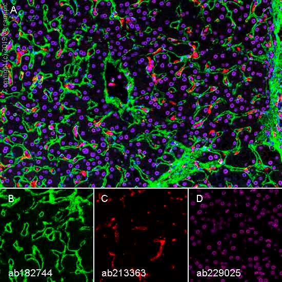 Multiplex immunohistochemistry - Anti-Lamin B1 antibody [EPR22165-121] - Nuclear Envelope Marker (ab229025), expandable thumbnail