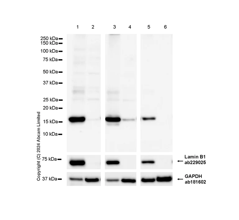 Western blot - Anti-Lamin B1 antibody [EPR22165-121] - Nuclear Envelope Marker (AB229025)