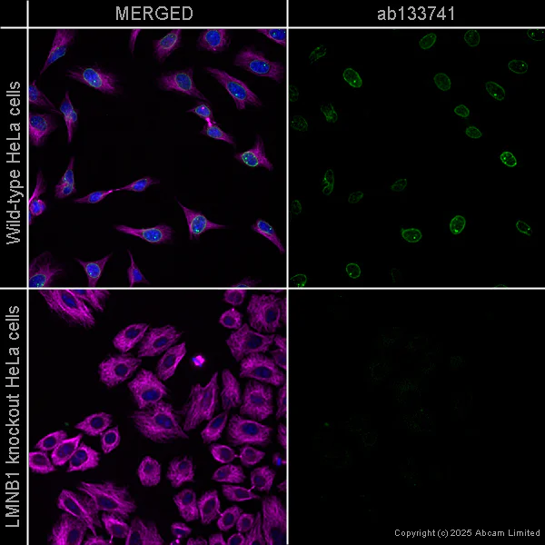 Immunocytochemistry/ Immunofluorescence - Anti-Lamin B1 antibody [EPR8985(B)] - BSA and Azide free (AB220797)