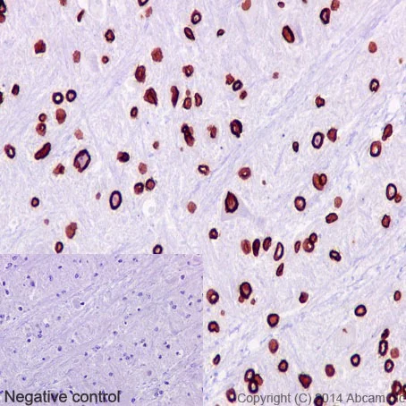 Immunohistochemistry (Formalin/PFA-fixed paraffin-embedded sections) - Anti-Lamin B1 antibody [EPR8985(B)] - BSA and Azide free (AB220797)