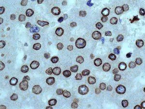 Immunohistochemistry (Formalin/PFA-fixed paraffin-embedded sections) - Anti-Lamin B1 antibody [EPR8985(B)] - BSA and Azide free (AB220797)