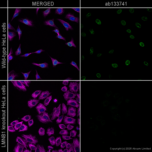 たみこ様 Anti-lamin B1 antibody [EPR8985(B)] - nuclear envelope marker