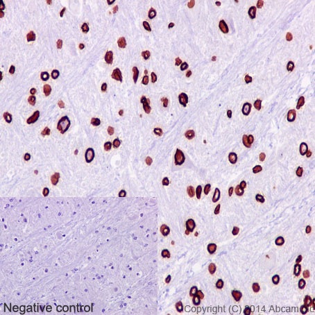 Immunohistochemistry (Formalin/PFA-fixed paraffin-embedded sections) - Anti-Lamin B1 antibody [EPR8985(B)] - Nuclear Envelope Marker (ab133741), expandable thumbnail