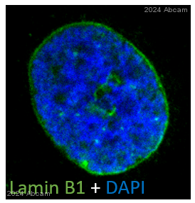 Immunocytochemistry/ Immunofluorescence - Anti-Lamin B1 antibody - Nuclear Envelope Marker (ab16048), expandable thumbnail