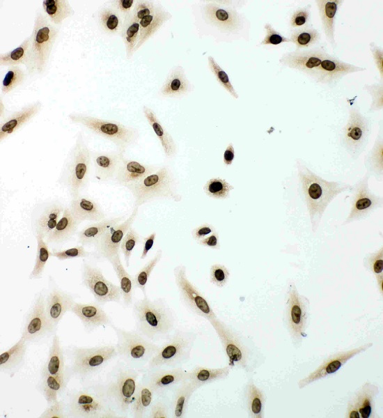 Immunocytochemistry - Anti-Lamin B1 antibody (AB65986), expandable thumbnail