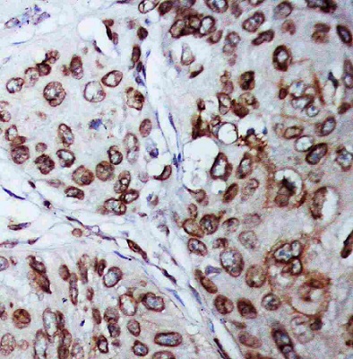 Immunohistochemistry (Formalin/PFA-fixed paraffin-embedded sections) - Anti-Lamin B1 antibody (AB65986), expandable thumbnail