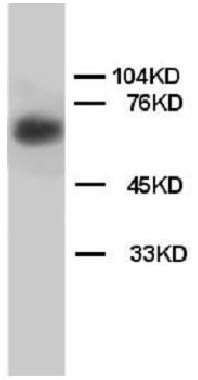 Western blot - Anti-Lamin B1 antibody - Nuclear Envelope Marker (AB65986), expandable thumbnail