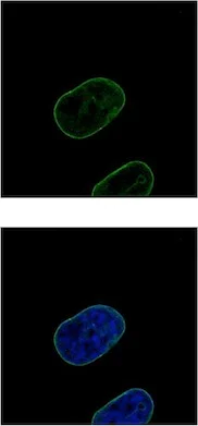 Immunocytochemistry/ Immunofluorescence - Anti-Lamin B2 antibody (AB155319)