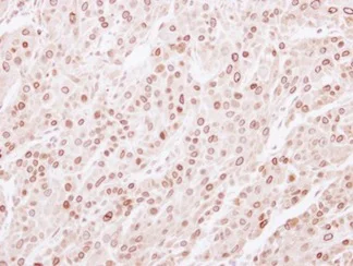 Immunohistochemistry (Formalin/PFA-fixed paraffin-embedded sections) - Anti-Lamin B2 antibody (AB155319)