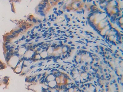 Immunohistochemistry (Formalin/PFA-fixed paraffin-embedded sections) - Anti-Lamin B2 antibody (AB233530)