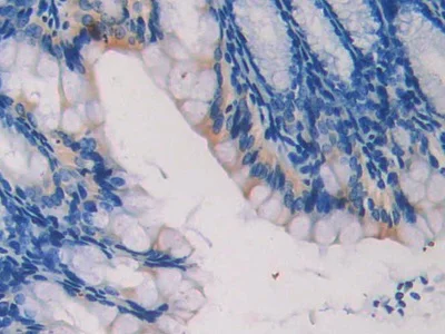 Immunohistochemistry (Formalin/PFA-fixed paraffin-embedded sections) - Anti-Lamin B2 antibody (AB233530)