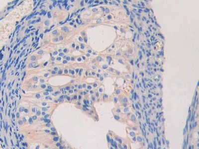 Immunohistochemistry (Formalin/PFA-fixed paraffin-embedded sections) - Anti-Lamin B2 antibody (AB233530)