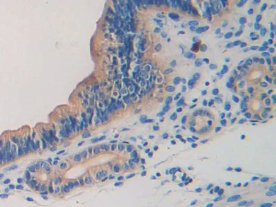 Immunohistochemistry (Formalin/PFA-fixed paraffin-embedded sections) - Anti-Lamin B2 antibody (AB233530)