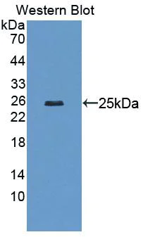 Western blot - Anti-Lamin B2 antibody (AB233530)