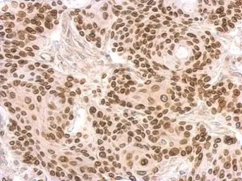 Immunohistochemistry (Formalin/PFA-fixed paraffin-embedded sections) - Anti-Lamin B2 antibody (AB97513)