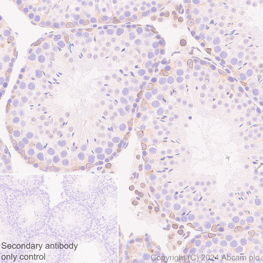 Immunohistochemistry (Formalin/PFA-fixed paraffin-embedded sections) - Anti-Lamin B2 antibody [EPR9701(B)] (ab151735), expandable thumbnail