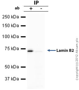Immunoprecipitation - Anti-Lamin B2 antibody [LN43] (AB8983), expandable thumbnail