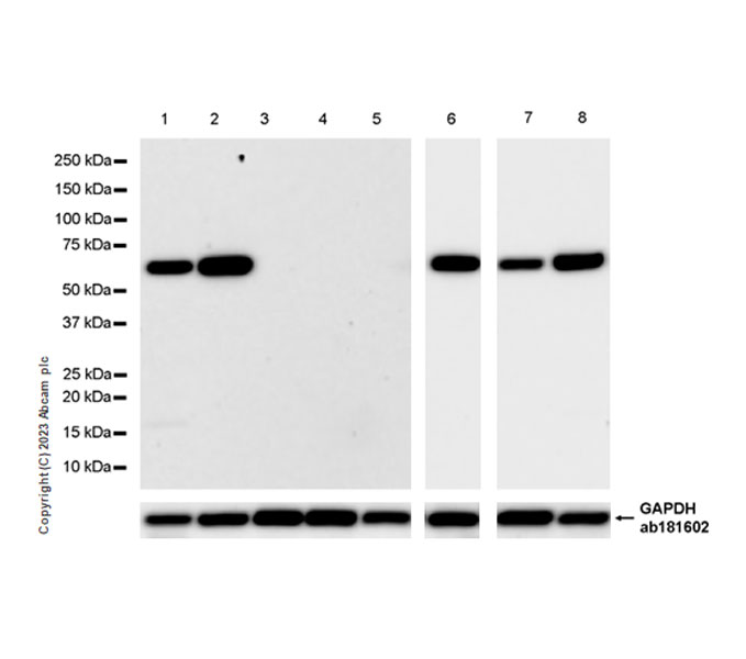 Western blot - Anti-Lamin C antibody [EPR28295-16] (ab314500), expandable thumbnail