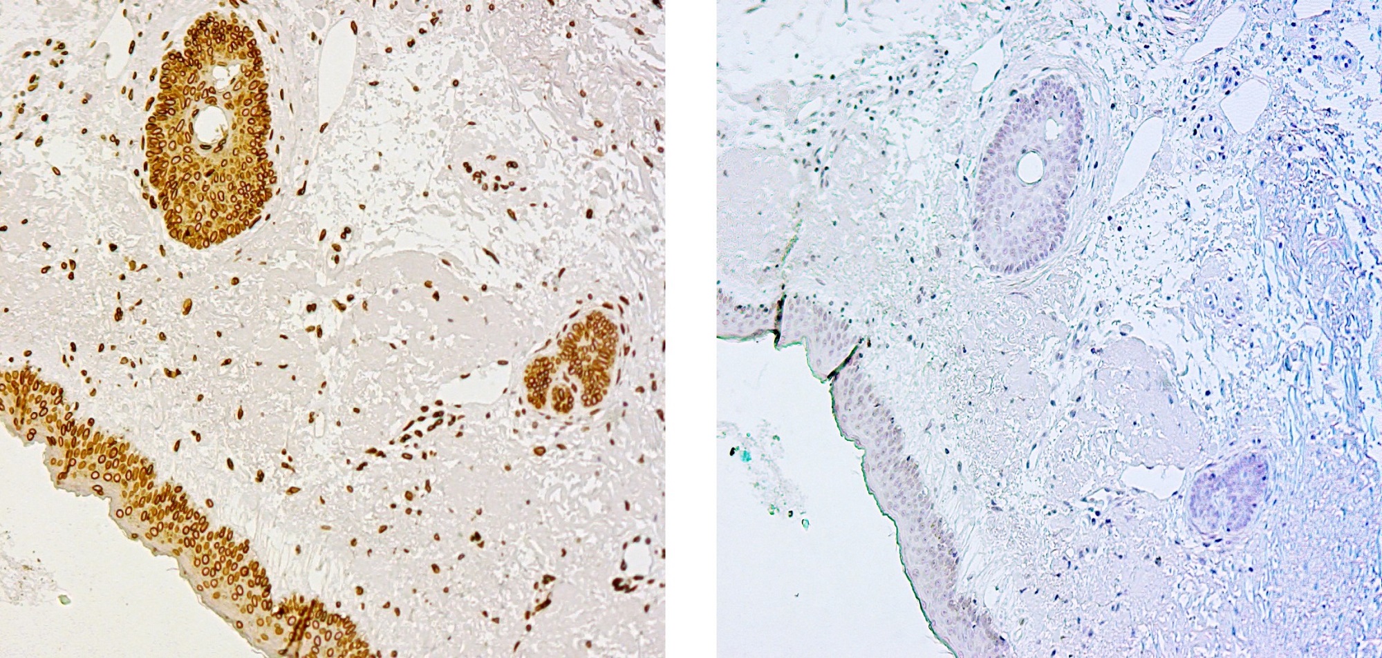 Immunohistochemistry (Formalin/PFA-fixed paraffin-embedded sections) - Anti-Lamin C antibody (AB125679), expandable thumbnail