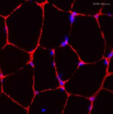 Immunohistochemistry (Frozen sections) - Anti-Laminin 2 alpha antibody [4H8-2] (AB11576), expandable thumbnail