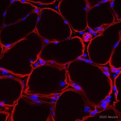 Immunohistochemistry (Frozen sections) - Anti-Laminin 2 alpha antibody [4H8-2] (AB11576), expandable thumbnail
