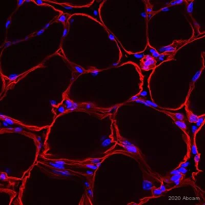 Immunohistochemistry (Frozen sections) - Anti-Laminin 2 alpha antibody [4H8-2] (AB11576)