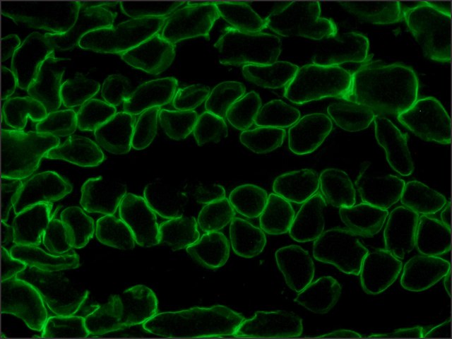 Immunohistochemistry (Frozen sections) - Anti-Laminin 2 alpha antibody [4H8-2] (AB11576), expandable thumbnail