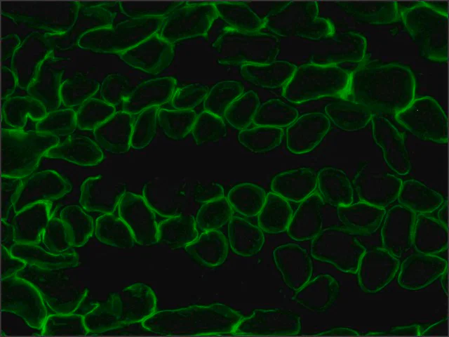 Immunohistochemistry (Frozen sections) - Anti-Laminin 2 alpha antibody [4H8-2] (AB11576)