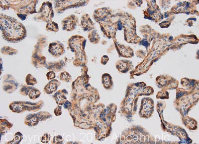 Immunohistochemistry (Formalin/PFA-fixed paraffin-embedded sections) - Anti-Laminin 2 alpha antibody (AB140482)