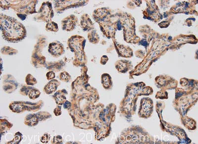 Immunohistochemistry (Formalin/PFA-fixed paraffin-embedded sections) - Anti-Laminin 2 alpha antibody (AB140482)