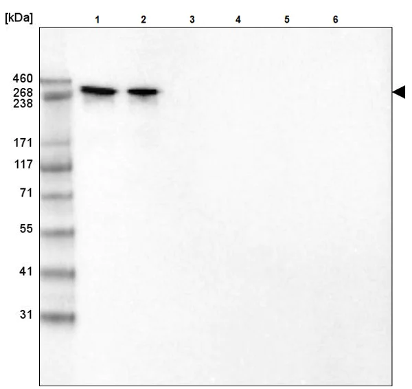 Western blot - Anti-Laminin 2 alpha antibody [CL3450] (AB236762)