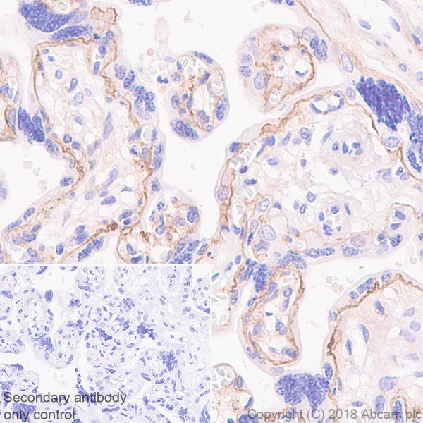 Immunohistochemistry (Formalin/PFA-fixed paraffin-embedded sections) - Anti-Laminin 2 alpha antibody [EPR21890] (AB219409)