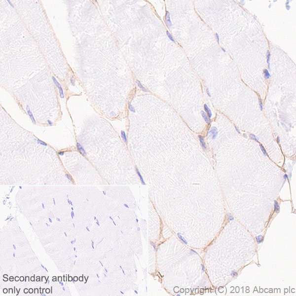 Immunohistochemistry (Formalin/PFA-fixed paraffin-embedded sections) - Anti-Laminin 2 alpha antibody [EPR21890] - BSA and Azide free (AB238458)