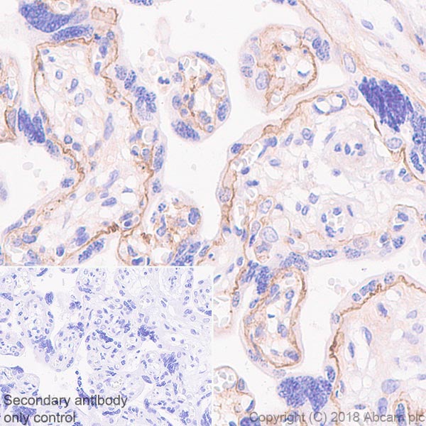 Immunohistochemistry (Formalin/PFA-fixed paraffin-embedded sections) - Anti-Laminin 2 alpha antibody [EPR21890] - BSA and Azide free (AB238458)