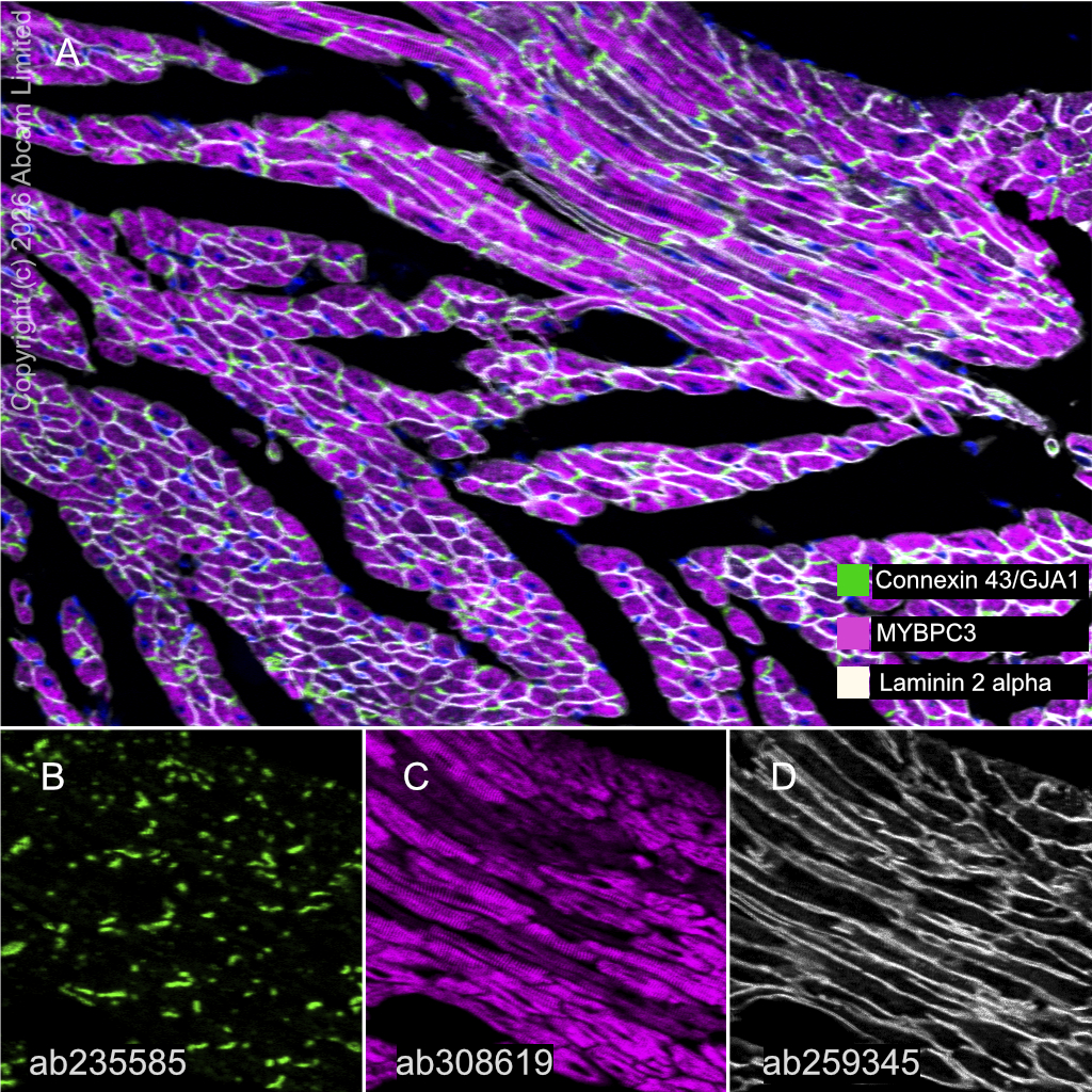 Multiplex immunohistochemistry - Anti-Laminin 2 alpha antibody [EPR23924-60] (AB259345)
