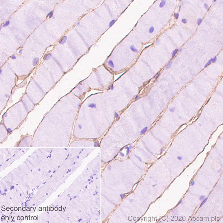 Immunohistochemistry (Formalin/PFA-fixed paraffin-embedded sections) - Anti-Laminin 2 alpha antibody [EPR23924-60] - BSA and Azide free (AB275258)
