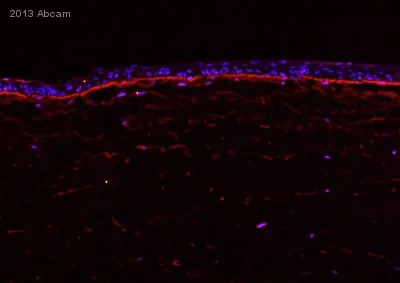 Immunohistochemistry (Frozen sections) - Anti-Laminin 5 antibody [P3H9-2] (AB78286)