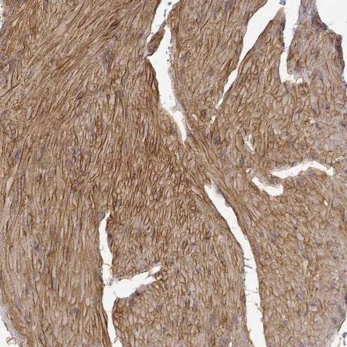 Immunohistochemistry (Formalin/PFA-fixed paraffin-embedded sections) - Anti-Laminin alpha 4/LAMA4 antibody (AB244345)