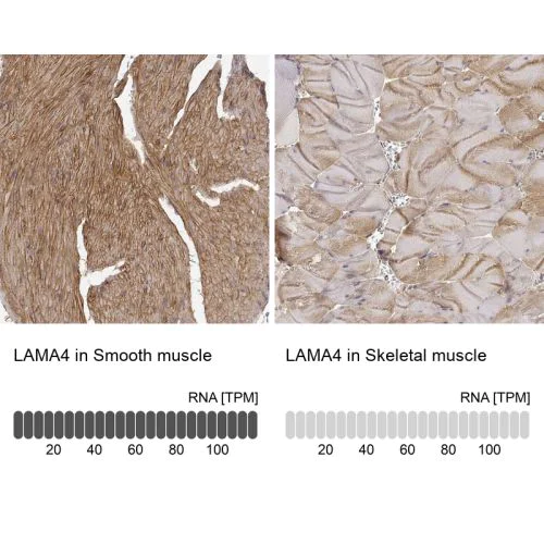 Immunohistochemistry (Formalin/PFA-fixed paraffin-embedded sections) - Anti-Laminin alpha 4/LAMA4 antibody (AB244345)