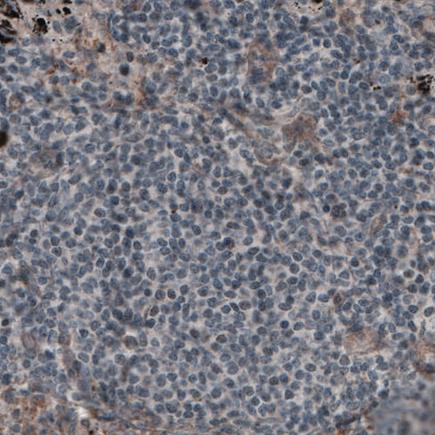 Immunohistochemistry (Formalin/PFA-fixed paraffin-embedded sections) - Anti-Laminin alpha 4/LAMA4 antibody [CL3183] (AB242198)